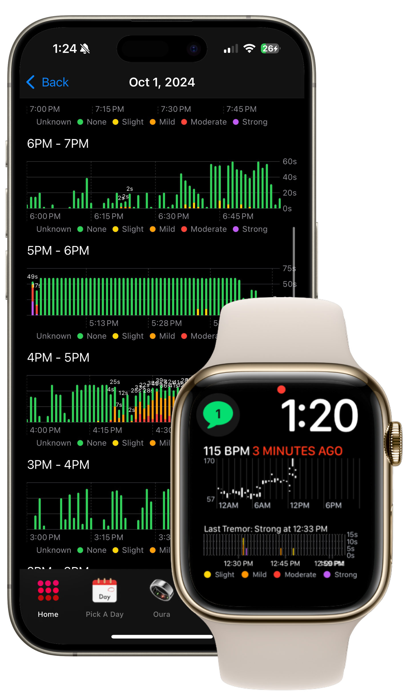 HeartCloud tremor monitoring on iPhone and Apple Watch