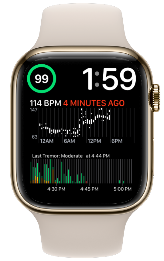 Apple Watch (HeartCloud Sync App) Tremor Monitoring Buttons