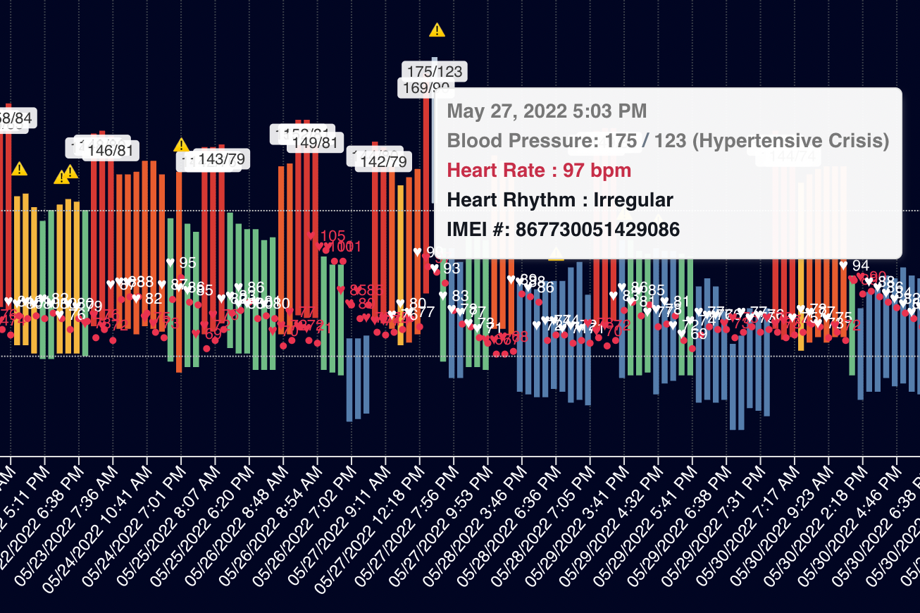 Screenshot of blood pressure readings in red, orange, yellow, green, and blue with vertical lines annotating irregular heart rhythm at the time a blood pressure reading was taken