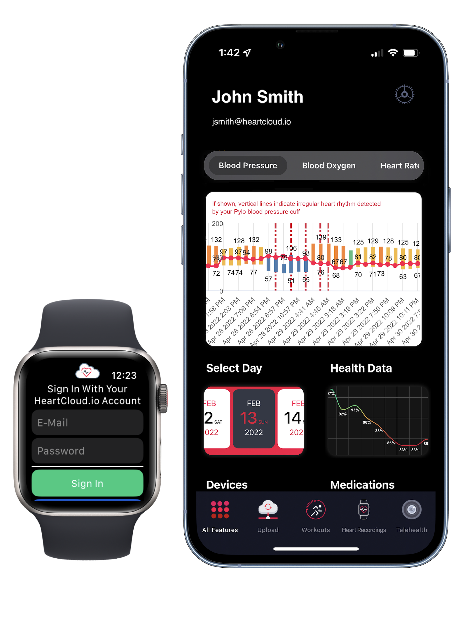 HeartCloud Sync on Blue iPhone 13 Pro showing blood pressure chart and HeartCloud Sync sign in page on Apple Watch