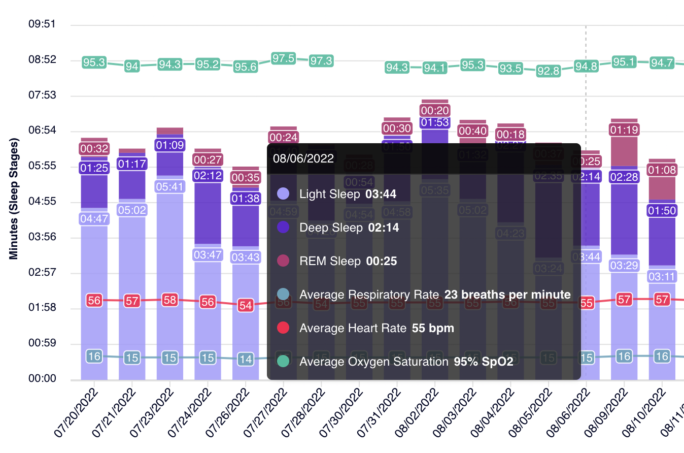 HeartCloud sleep chart showing light, deep, and REM sleep with heart rate and respiratory data